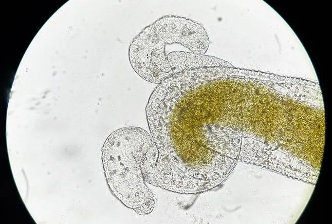 enfermedades parasitarias