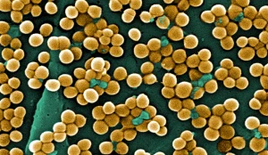 Una imagen en primer plano de numerosas bacterias redondas agrupadas, representadas en tonos amarillos y dorados sobre un fondo verde oscuro, captada con un microscopio electrónico de barrido. Esta imagen pone de relieve la importancia de los materiales antimicrobianos desarrollados por el CSIC para evitar las infecciones causadas por este tipo de agrupaciones bacterianas.