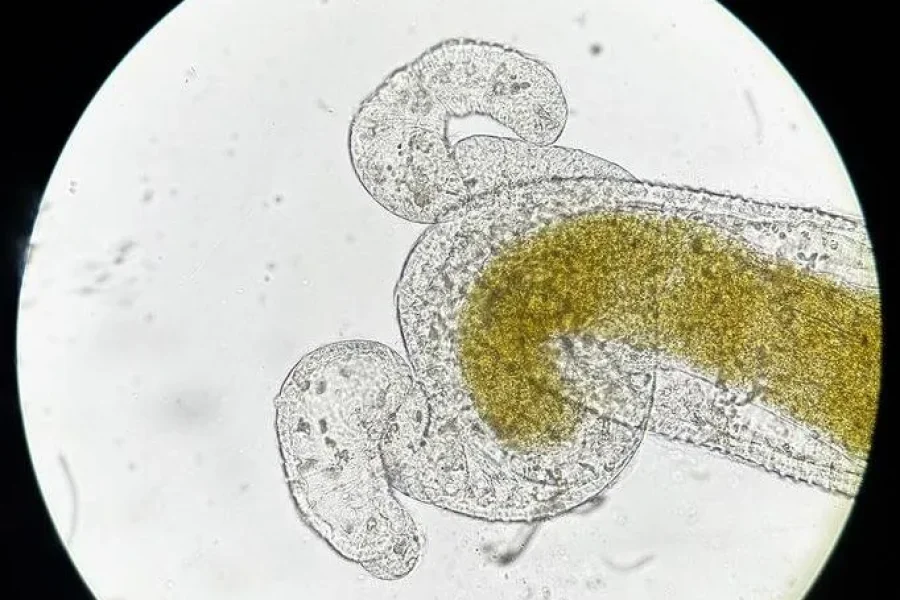 enfermedades parasitarias