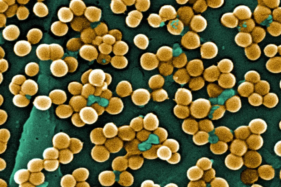 Una imagen en primer plano de numerosas bacterias redondas agrupadas, representadas en tonos amarillos y dorados sobre un fondo verde oscuro, captada con un microscopio electrónico de barrido. Esta imagen pone de relieve la importancia de los materiales antimicrobianos desarrollados por el CSIC para evitar las infecciones causadas por este tipo de agrupaciones bacterianas.